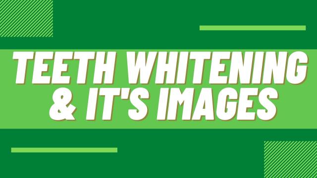 Teeth Whitening & it`s Images