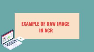 Example of raw image in ACR